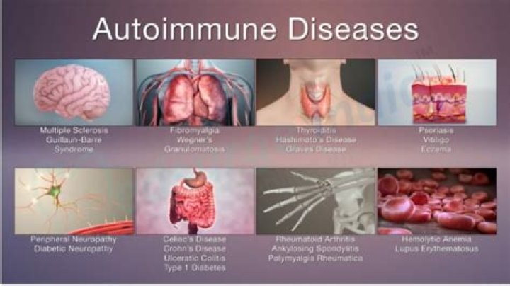 At what age do autoimmune diseases show up?