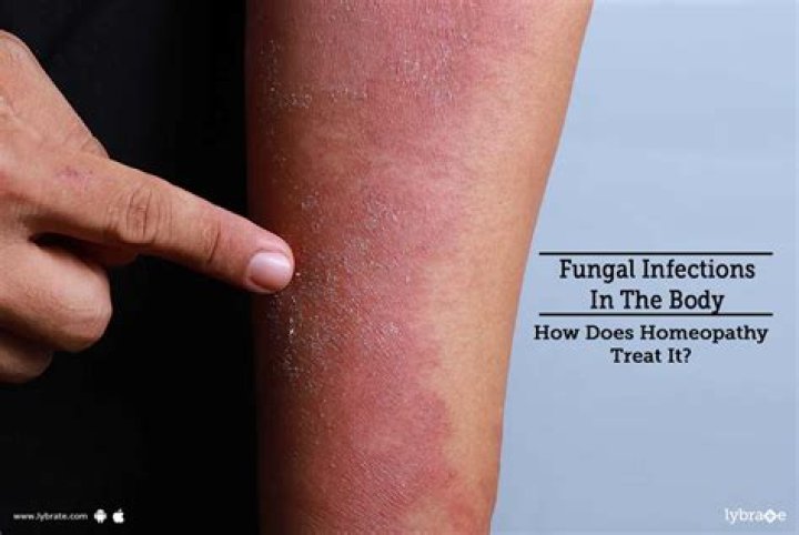 Can fungus grow inside your body?