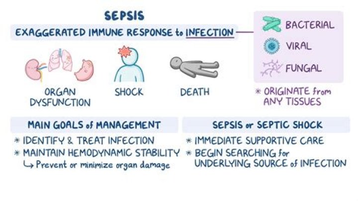 Can you get sepsis from cholecystitis?