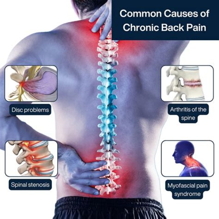 Can you work with chronic back pain?