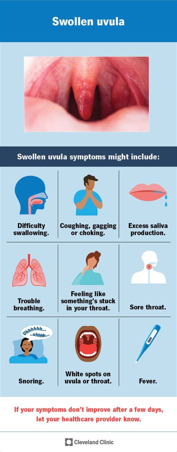 Does having your uvula removed change your voice?