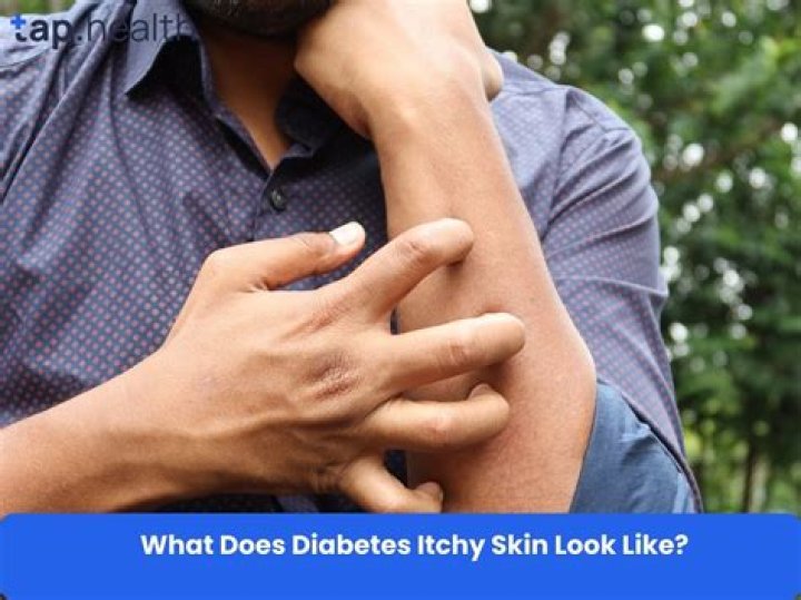 Does let down feel itchy?