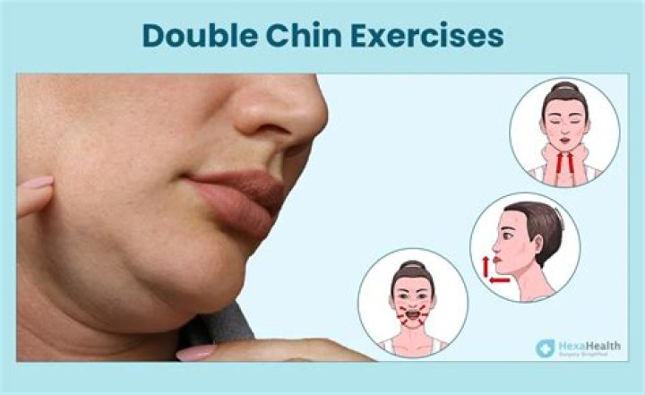 Does skin needling help double chin?