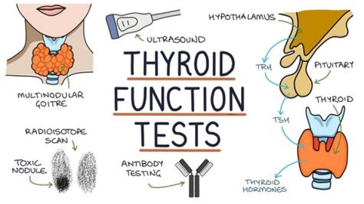 How do you test for thyroid lymphoma?