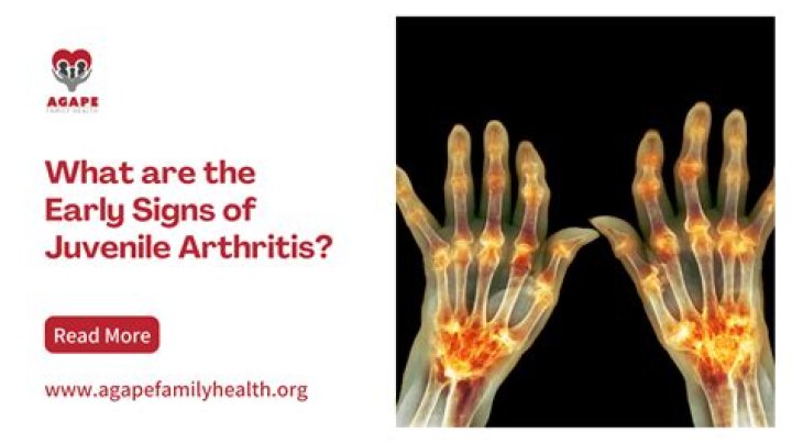 How early can you detect juvenile arthritis?
