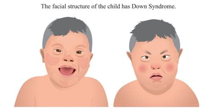 How much can a person with Down syndrome make?