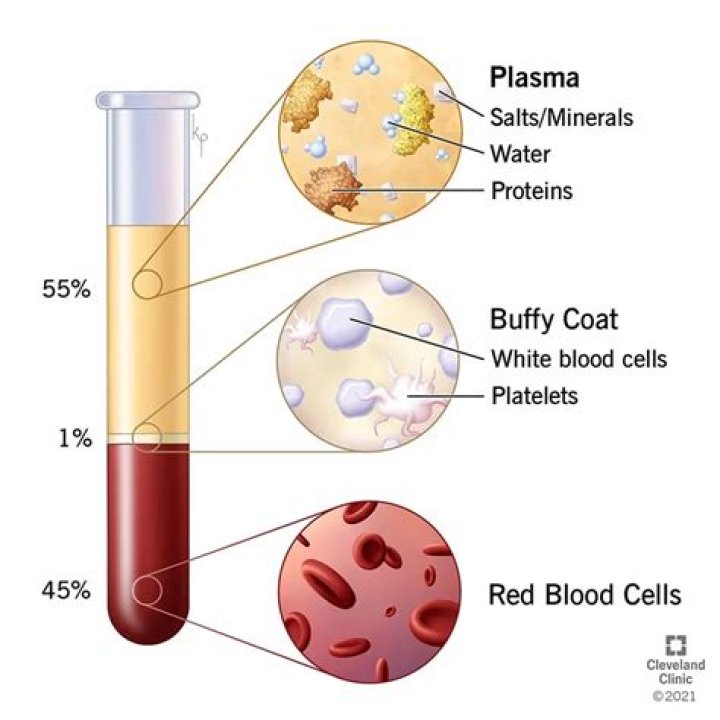 How much does a plasma transfusion cost?