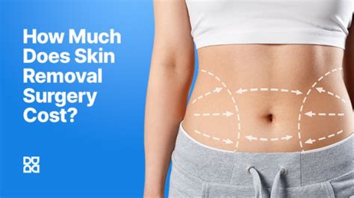 How much does it cost to have excess skin removed?
