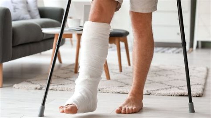 How much is a settlement for a broken leg?
