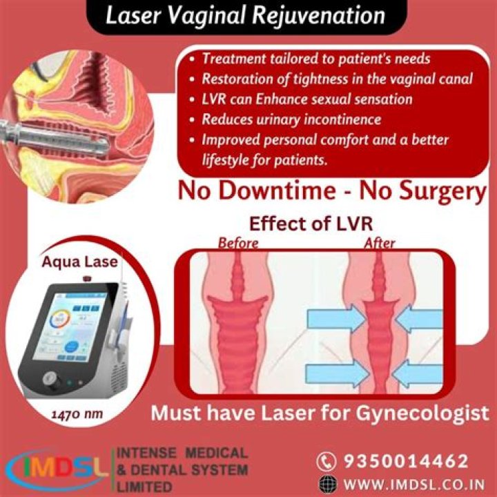 How much is laser vaginal surgery?