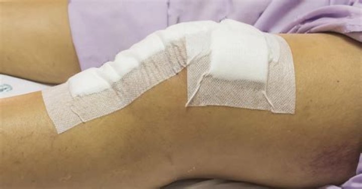 How serious is knee revision surgery?