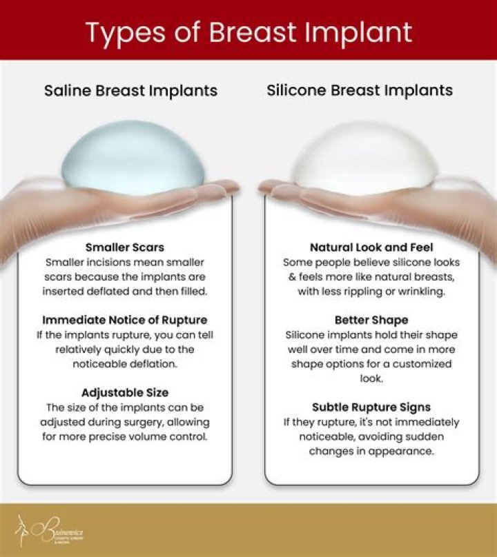Is it OK to have breast implants for 20 years?