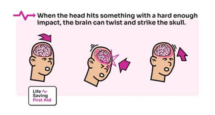 Should you hit an animal or swerve?