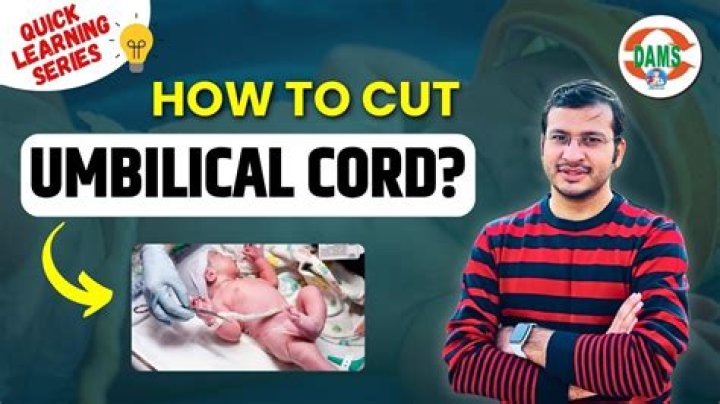 Should you immediately cut the umbilical cord?