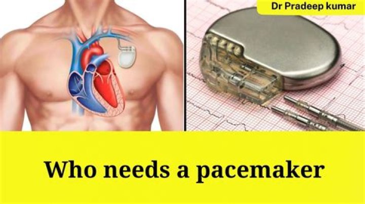 What can't you do with a pacemaker fitted?