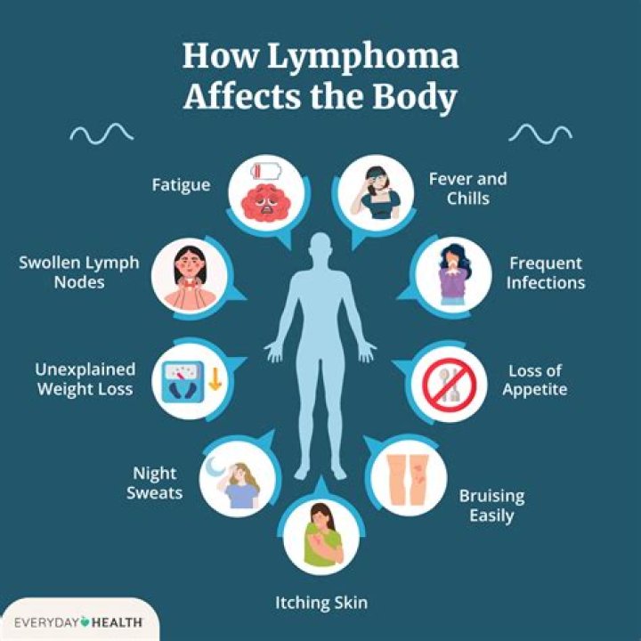 What do you get someone diagnosed with lymphoma?
