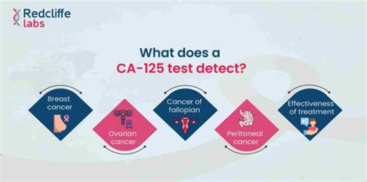 What does CA Cupid stand for?