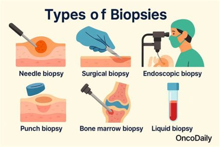 What happens if a biopsy is positive?