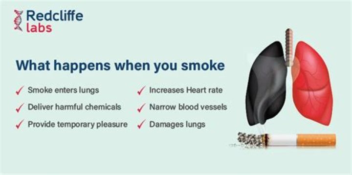 What happens when sharesave matures?