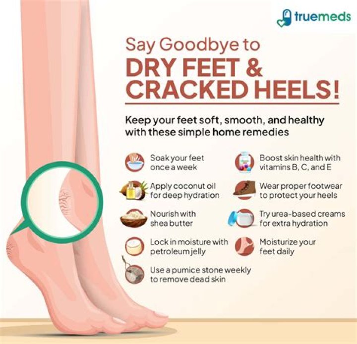 What is a home remedy for dry cracked feet?
