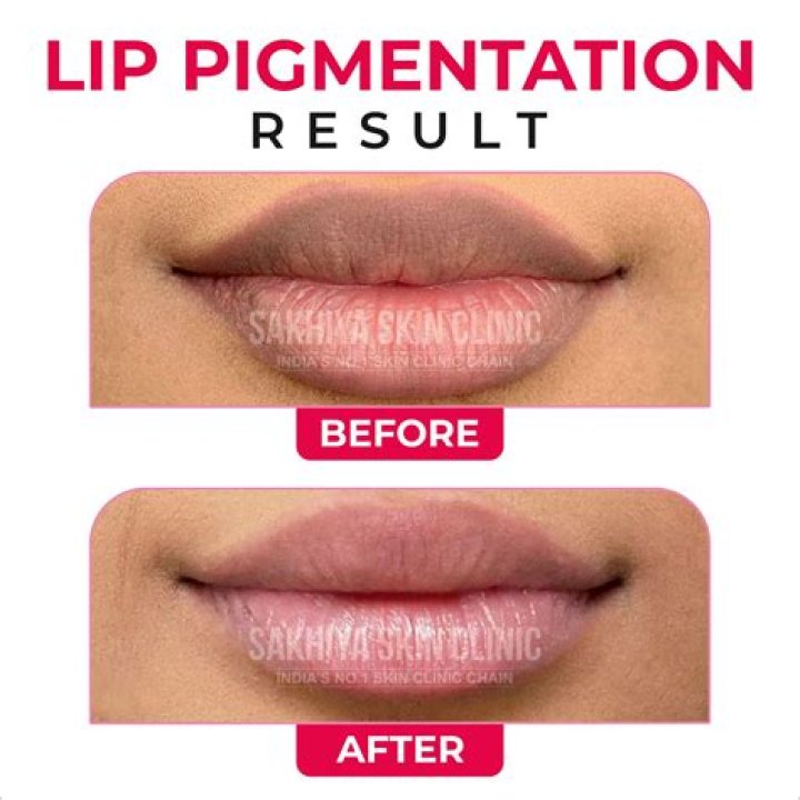 What is the fastest way to cure pigmentation?