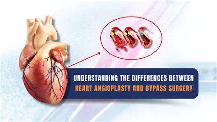 What is the life expectancy after heart bypass surgery?