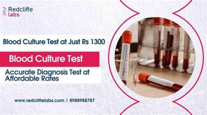 What is the purpose of a residents association?