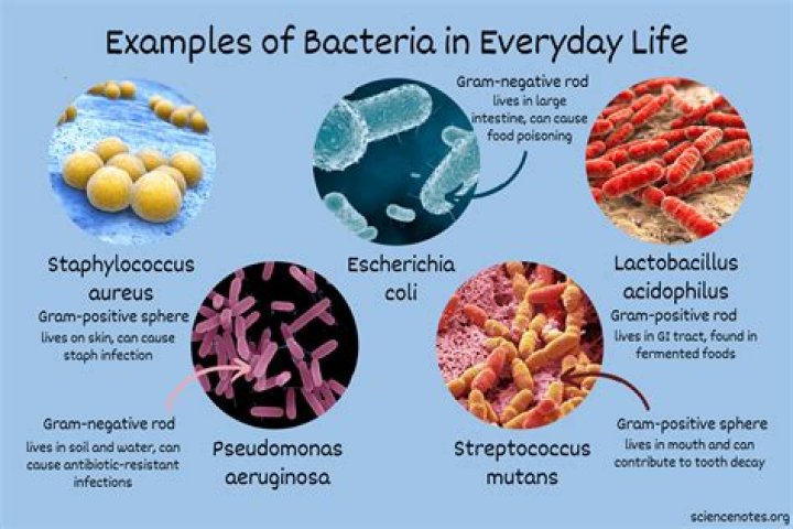 What items have most bacteria?