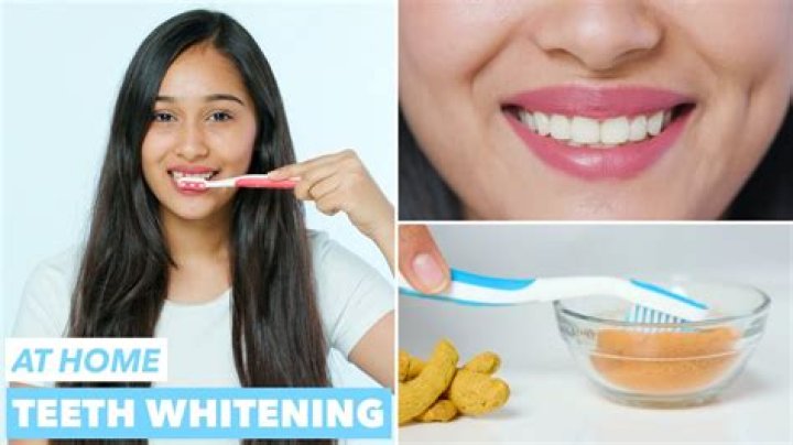 What will whiten my teeth?