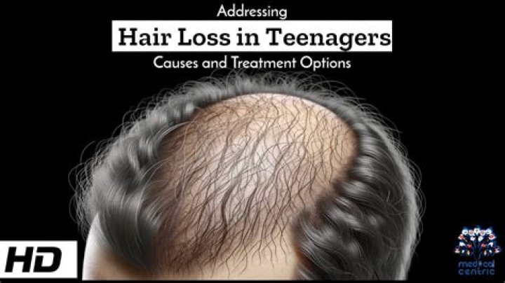 Why do teenage girls lose so much hair?