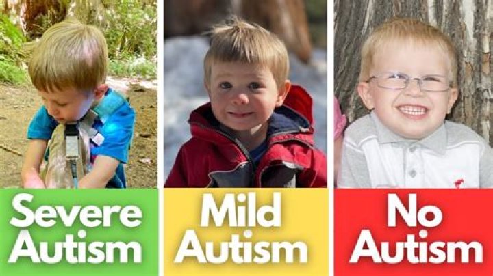 Will my autistic child ever live on his own?